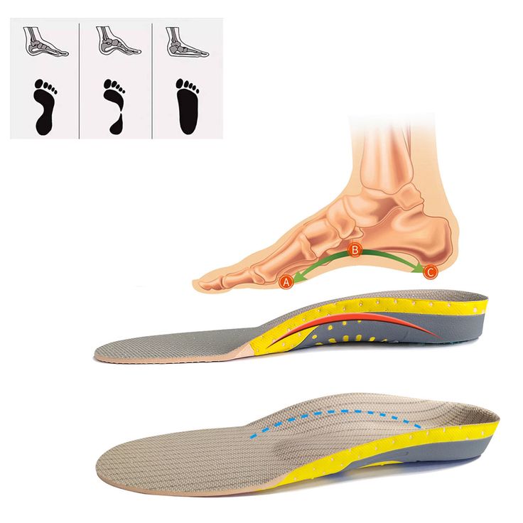 Choosing the Right Orthopedic Insoles for Your Feet – A Complete Guide - Ammpoure Wellbeing