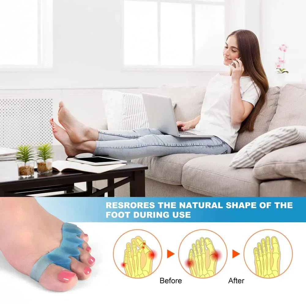 From Flat Feet to Happy Toes – How Silicone Toe Orthotics Support Better Posture - Ammpoure Wellbeing
