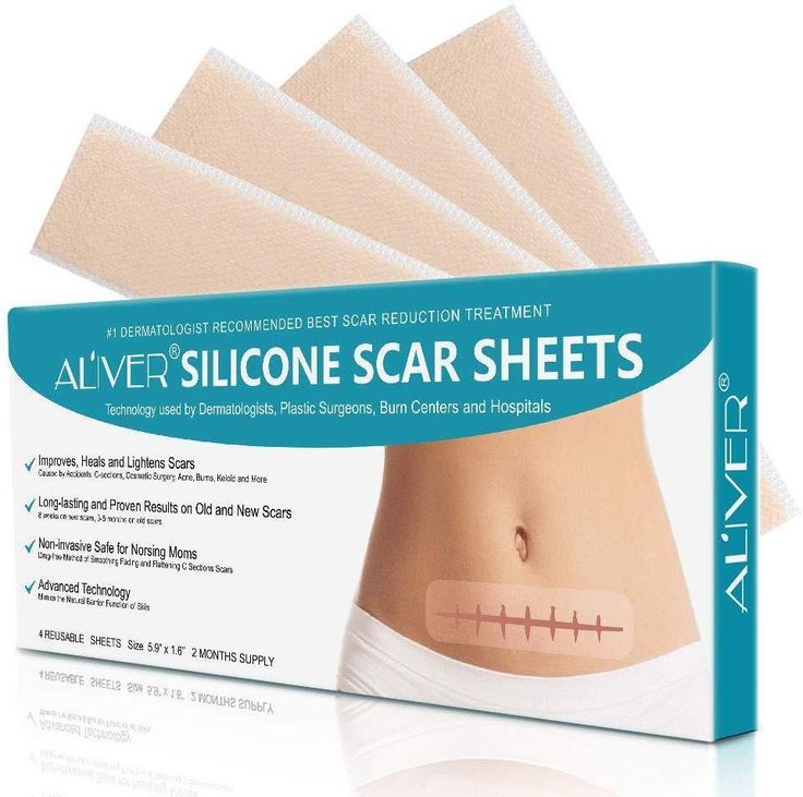 Why Silicone Scar Sheets Deserve a Spot in Your Skincare Routine - Ammpoure Wellbeing